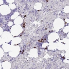 Anti-ZFP62 Antibody
