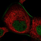 Immunofluorescent staining of human cell line A-431 shows localization to nucleoplasm & actin filaments.