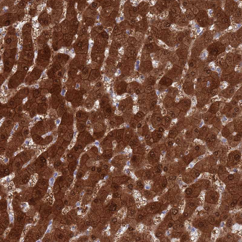 Anti-MAT1A Antibody