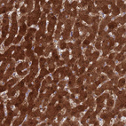 Anti-MAT1A Antibody