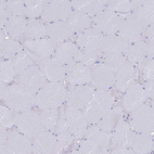 Immunohistochemical staining of human skeletal muscle shows no positivity in myocytes as expected.