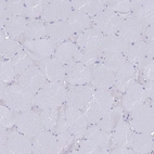Immunohistochemical staining of human skeletal muscle shows no positivity in myocytes as expected.