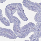 Immunohistochemical staining of human fallopian tube shows no positivity in glandular cells as expected.