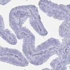 Immunohistochemical staining of human fallopian tube shows no positivity in glandular cells as expected.