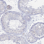 Immunohistochemical staining of human testis shows no positivity in cells in seminiferous ducts as expected.