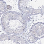 Immunohistochemical staining of human testis shows no positivity in cells in seminiferous ducts as expected.