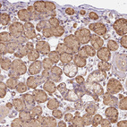 Anti-PPP1R1B Antibody