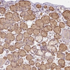 Anti-PPP1R1B Antibody