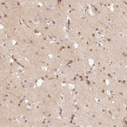 Immunohistochemical staining of human cerebral cortex shows moderate cytoplasmic-membranous positivity in endothelial cells, neurons and cytoplasmic positivity in neuropil.