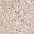 Immunohistochemical staining of human cerebral cortex shows moderate cytoplasmic-membranous positivity in endothelial cells, neurons and cytoplasmic positivity in neuropil.