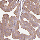 Immunohistochemical staining of human fallopian tube shows moderate cytoplasmic membranous positivity in glandular cells and ciliated cells