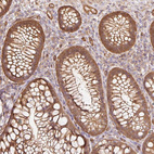 Immunohistochemical staining of human colon shows moderate cytoplasmic membranous positivity in glandular cells and endothelial cells.