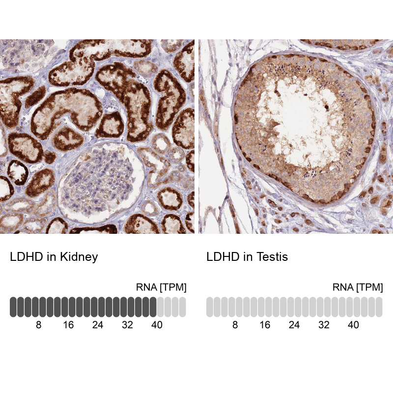 Anti-LDHD Antibody