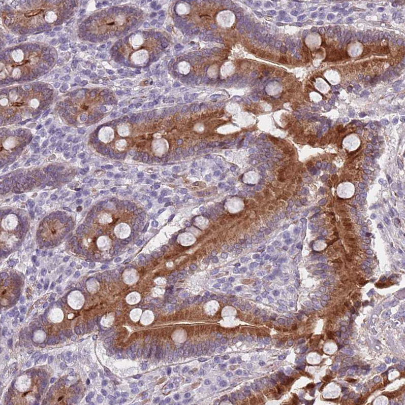 Anti-TMC4 Antibody