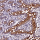 Anti-TMC4 Antibody
