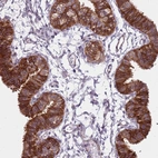 Immunohistochemical staining of human fallopian tube shows strong cytoplasmic positivity in glandular cells.