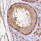 Immunohistochemical staining of human testis shows low expression as expected.