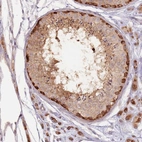 Immunohistochemical staining of human testis shows low expression as expected.