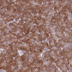 Anti-TMC4 Antibody