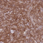 Immunohistochemical staining of human pancreas shows strong cytoplasmic positivity in exocrine glandular cells.