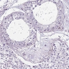Immunohistochemical staining of human testis shows no cytoplasmic positivity in cells in seminiferous ducts as expected.