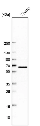 Western blot analysis in human cell line TD47D.