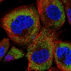 Immunofluorescent staining of human cell line A-431 shows localization to cytosol.