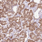 Anti-AAR2 Antibody