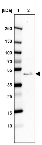 Lane 1: Marker [kDa] 250, 130, 100, 70, 55, 35, 25, 15, 10_br/_Lane 2: Human cell line CACO-2