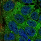 Immunofluorescent staining of human cell line CACO-2 shows localization to cytosol.