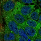 Immunofluorescent staining of human cell line CACO-2 shows localization to cytosol.