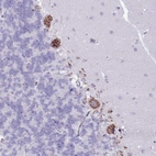 Anti-C20orf96 Antibody