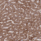 Anti-GSTM1 Antibody