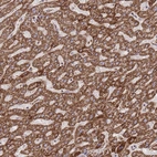 Anti-GSTM1 Antibody