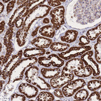 Immunohistochemical staining of human Kidney shows strong granular cytoplasmic positivity in cells in tubules.