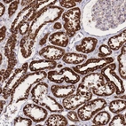 Immunohistochemical staining of human Kidney shows strong granular cytoplasmic positivity in cells in tubules.