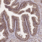 Immunohistochemical staining of human Prostate shows strong granular cytoplasmic positivity in glandular cells.