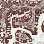 Immunohistochemical staining of human Small intestine shows strong granular cytoplasmic positivity in glandular cells.