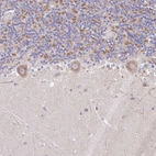 Immunohistochemical staining of human cerebellum shows moderate granular cytoplasmic positivity in Purkinje cells.