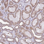Immunohistochemical staining of human kidney shows moderate granular cytoplasmic positivity in cells in tubules.