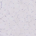 Immunohistochemical staining of human skeletal muscle shows no positivity in myocytes as expected.