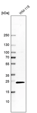 Western blot analysis in human cell line WM-115.