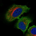 Immunofluorescent staining of human cell line HeLa shows localization to plasma membrane, cytosol & endoplasmic reticulum.