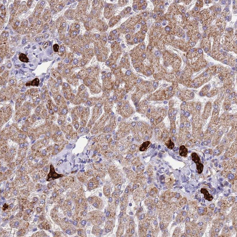 Anti-ZDHHC1 Antibody