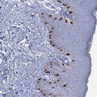 Immunohistochemical staining of human skin shows strong cytoplasmic positivity in melanocytes.