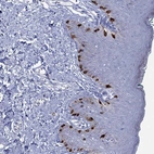 Immunohistochemical staining of human skin shows strong cytoplasmic positivity in melanocytes.