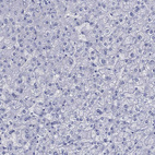 Immunohistochemical staining of human liver shows no positivity in hepatocytes as expected.