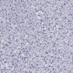 Immunohistochemical staining of human liver shows no positivity in hepatocytes as expected.
