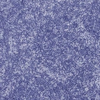Immunohistochemical staining of human lymph node shows no positivity in non-germinal center cells as expected.