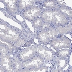 Immunohistochemical staining of human kidney shows no positivity in cells in tubules as expected.